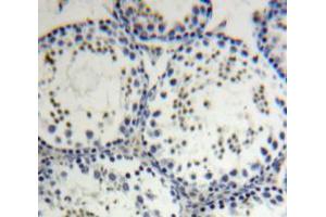 Immunohistochemistry (IHC) image for anti-Solute Carrier Family 22 (Organic Cation Transporter), Member 1 (SLC22A1) (AA 128-391) antibody (ABIN2117055)