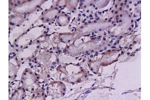 Formalin-fixed and paraffin embedded: rat kidney tissue labeled with Anti-ET-1 Polyclonal Antibody (ABIN726035), Unconjugated at 1:200, followed by conjugation to the secondary antibody and DAB staining (Prepro-Endothelin-1 (AA 16-110) 抗体)
