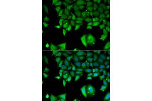 Immunofluorescence analysis of A549 cells using IL17F antibody (ABIN5973881).