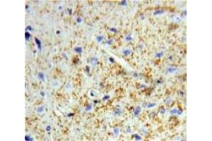 Used in DAB staining on fromalin fixed paraffin-embedded Brain tissue (Dermatopontin 抗体  (AA 26-197))
