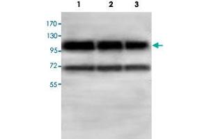 Western blot analysis of HepG2 (Lane 1) and 293T (Lane 2) and HeLa cell lysates with ABCF1 polyclonal antibody  at 1 : 500 dilution.