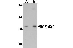 Western blot analysis of MMS21 in 293 cell lysate with MMS21 antibody at (A) 0. (NSMCE2 抗体  (C-Term))