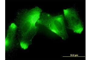 Immunofluorescence of monoclonal antibody to MFRP on HeLa cell. (MFRP 抗体  (AA 480-579))