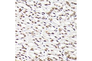 Immunohistochemistry (IHC) image for anti-RAD21 Homolog (RAD21) antibody (ABIN7269822)