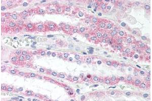 Human Kidney (formalin-fixed, paraffin-embedded) stained with VAMP5 antibody ABIN337073 at 10 ug/ml followed by biotinylated goat anti-rabbit IgG secondary antibody ABIN481713, alkaline phosphatase-streptavidin and chromogen. (VAMP5 抗体  (N-Term))