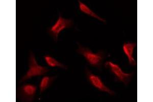 ABIN6269325 staining NIH-3T3 by IF/ICC. (PKC zeta 抗体  (C-Term))