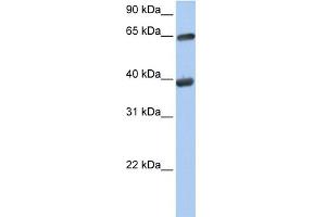 WB Suggested Anti-TKT Antibody Titration:  0. (TKT 抗体  (N-Term))