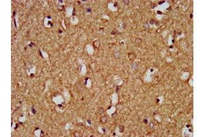 IHC image of ABIN7154814 diluted at 1:200 and staining in paraffin-embedded human brain tissue performed on a Leica BondTM system. (HEY1 抗体  (AA 200-300))