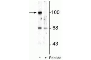 Western blot of rat brain lysate showing specific immunolabeling of the ~100 kDa GluR2 protein phosphorylated at Ser880 in the first lane (-). (GRIA2 抗体  (pSer880))