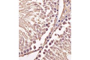 Immunohistochemical analysis of paraffin-embedded M. (Cyclin B1 抗体  (AA 103-130))