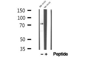 Western blot analysis of extracts of SH-SY5Y cells, using MECP2 antibody. (MECP2 抗体  (C-Term))