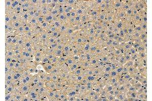 ABIN6258662 and ABIN6275251 at 1/100 staining Mouse liver tissue by IHC-P. (SLC16A2/MCT8 抗体  (Internal Region))