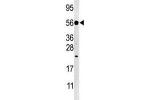 Western Blotting (WB) image for anti-Dual Specificity Phosphatase 8 (DUSP8) antibody (ABIN3003767) (DUSP8 抗体)