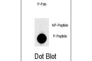 Dot Blot (DB) image for anti-Lin-28 Homolog A (C. Elegans) (LIN28A) (pSer134) antibody (ABIN3001930) (LIN28A 抗体  (pSer134))