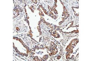 IHC analysis of FOXO3A using anti-FOXO3A antibody (ABIN3042404). (FOXO3 抗体  (AA 471-673))