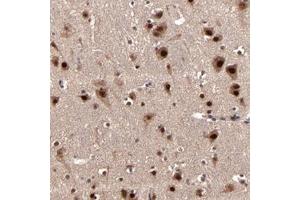 Immunohistochemical staining of human cerebral cortex with NXF5 polyclonal antibody  shows strong nuclear and moderate cytoplasmic positivity in neuronal cells at 1:10-1:20 dilution. (Nuclear RNA Export Factor 2B (NXF2B) 抗体)