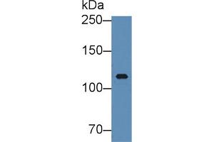 Western blot analysis of Human Serum, using Human ITIH3 Antibody (5 µg/ml) and HRP-conjugated Goat Anti-Rabbit antibody ( (ITIH3 抗体  (AA 279-467))