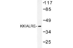 Image no. 1 for anti-Cyclin-Dependent Kinase-Like 1 (CDC2-Related Kinase) (CDKL1) antibody (ABIN272207) (CDKL1 抗体)