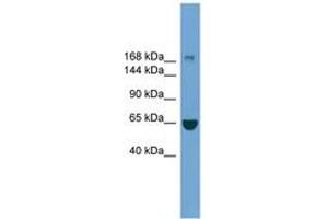 Image no. 1 for anti-Zinc Finger, CCHC Domain Containing 11 (ZCCHC11) (AA 1403-1452) antibody (ABIN6749768) (ZCCHC11 抗体  (AA 1403-1452))