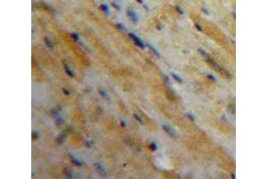 Used in DAB staining on fromalin fixed paraffin-embedded Heart tissue (MFAP5 抗体  (AA 25-152))