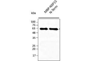 Western Blotting (WB) image for anti-SARS-CoV-2 Uridylate-Specific Endoribonuclease (NSP15) (N-Term) antibody (ABIN7273007) (SARS-CoV-2 NSP15 抗体  (N-Term))