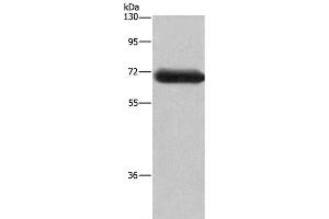 Western Blot analysis of Mouse brain tissue using DPYSL3 Polyclonal Antibody at dilution of 1:350 (DPYSL3 抗体)