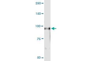 Immunoprecipitation of RIN1 transfected lysate using anti-RIN1 MaxPab rabbit polyclonal antibody and Protein A Magnetic Bead , and immunoblotted with RIN1 purified MaxPab mouse polyclonal antibody (B01P) . (RIN1 抗体  (AA 1-783))