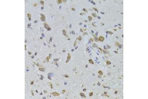 Immunohistochemistry of paraffin-embedded rat brain using RPL13 Antibody (ABIN2559760) at dilution of 1:100 (40x lens). (RPL13 抗体)