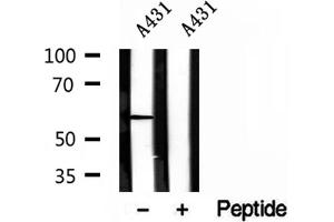 Western blot analysis of extracts of A431 cells, using HMGCS1 antibody. (HMGCS1 抗体  (Internal Region))