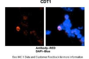 HC Suggested Anti-CDT1 antibody Titration:2 ug/ml Positive Control:Mouse brain stem cells (CDT1 抗体  (C-Term))