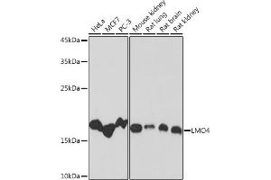 Western blot analysis of extracts of various cell lines, using LMO4 Rabbit mAb (ABIN7268258) at 1:1000 dilution. (LMO4 抗体)