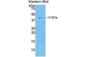 Detection of recombinant MDC using Polyclonal Antibody to Macrophage Derived Chemokine (MDC) (CCL22 抗体  (AA 25-93))