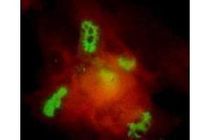 Immunofluorescence (IF) image for anti-Varicella Zoster Virus ORF62 (VZV IE62) antibody (ABIN265612) (Varicella Zoster Virus ORF62 (VZV IE62) 抗体)