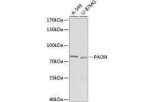 Western Blotting (WB) image for anti-Peptidyl Arginine Deiminase, Type IV (PADI4) (AA 374-550) antibody (ABIN7269207)