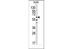 Image no. 1 for anti-V-Yes-1 Yamaguchi Sarcoma Viral Related Oncogene Homolog (LYN) (N-Term) antibody (ABIN359987) (LYN 抗体  (N-Term))