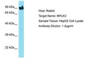 Image no. 1 for anti-Myosin Light Chain Kinase 3 (MYLK3) (C-Term) antibody (ABIN6750729) (MYLK3 抗体  (C-Term))