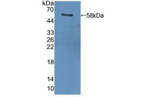 Western blot analysis of recombinant Human PCNA. (PCNA 抗体  (AA 6-261))