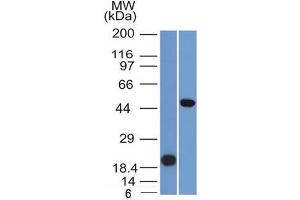 Western Blot Analysis (A) Recombinant Protein(B) Raji cell lysate UsingPAX8 Mouse Monoclonal Antibody (PAX8/1491). (PAX8 抗体  (AA 60-261))
