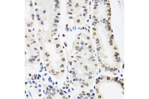 Immunohistochemistry of paraffin-embedded human stomach using SFPQ antibody. (SFPQ 抗体)