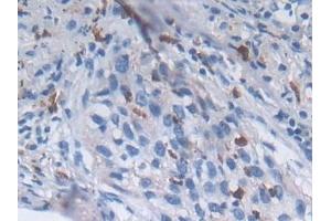 Immunohistochemistry (IHC) image for anti-Sema Domain, Immunoglobulin Domain (Ig), Short Basic Domain, Secreted, (Semaphorin) 3E (SEMA3E) (AA 32-516) antibody (ABIN7430111)
