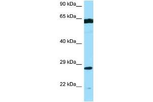 WB Suggested Anti-PMM2 AntibodyTitration: 1. (PMM2 抗体  (Middle Region))