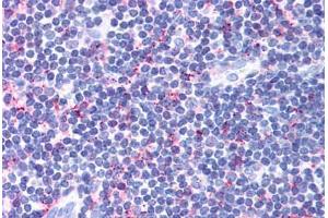 Human Tonsil (formalin-fixed, paraffin-embedded) stained with CCR4 antibody ABIN213490 at 10 ug/ml followed by biotinylated goat anti-rabbit IgG secondary antibody ABIN481713, alkaline phosphatase-streptavidin and chromogen. (CCR4 抗体  (Extracellular Domain))
