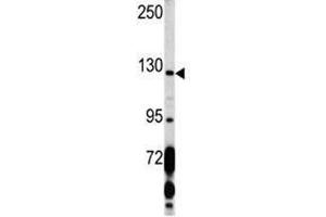 Western Blotting (WB) image for anti-Platelet Derived Growth Factor Receptor alpha (PDGFRA) (AA 1048-1077) antibody (ABIN3032254)