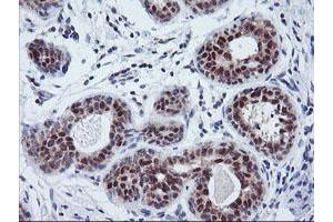 Immunohistochemical staining of paraffin-embedded Human breast tissue using anti-TIMP2 mouse monoclonal antibody. (TIMP2 抗体)