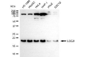 anti-Ubiquitin-Conjugating Enzyme E2I (UBE2I) antibody