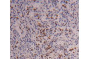 IHC-P analysis of Human Tissue, with DAB staining. (FOXO3 抗体  (AA 369-633))