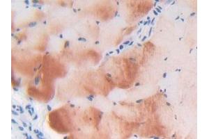 Detection of LTBP1 in Mouse Skeletal muscle Tissue using Polyclonal Antibody to Latent Transforming Growth Factor Beta Binding Protein 1 (LTBP1)