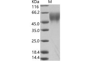 Western Blotting (WB) image for Zaire Ebola Virus Envelope Glycoprotein (ZEBOV GP) protein (ABIN7198929) (ZEBOV GP 蛋白)