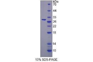 Image no. 1 for Follistatin-Like 3 (Secreted Glycoprotein) (FSTL3) (AA 24-256) protein (His tag) (ABIN4990769)