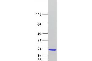 Western Blotting (WB) image for Nudix (Nucleoside Diphosphate Linked Moiety X)-Type Motif 1 (NUDT1) (Transcript Variant 2A) protein (Myc-DYKDDDDK Tag) (ABIN2727723)